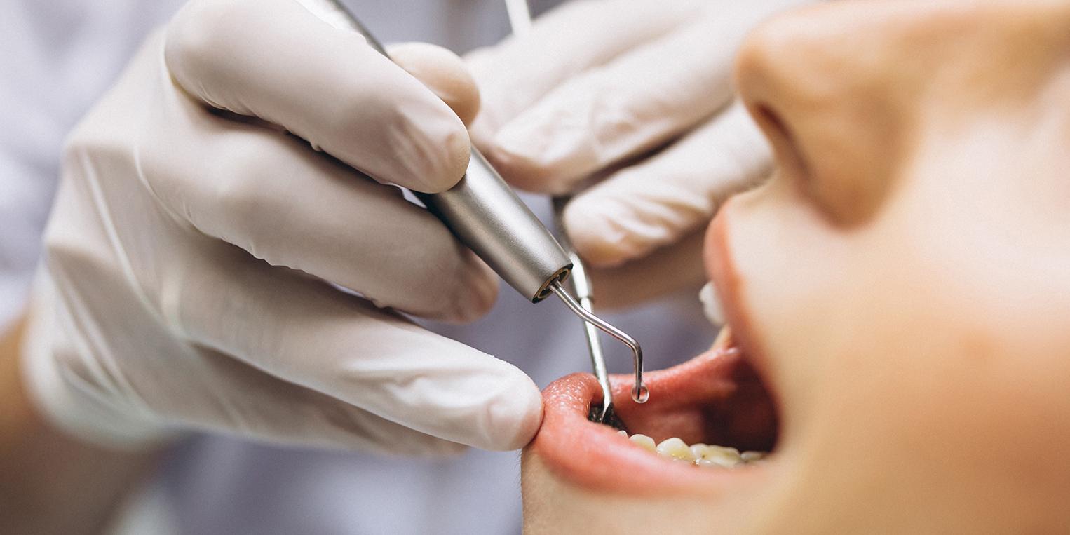 Endodoncia